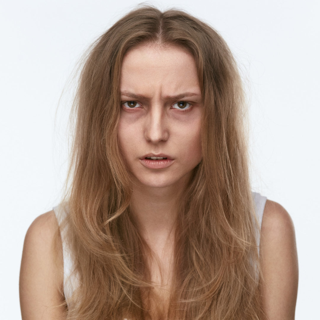How to Treat Dark Under Eye Circles