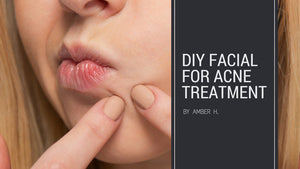 DIY at home Acne Facial Treatment